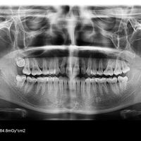 HDSN Community Dental Clinic 